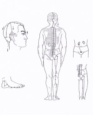 mechyre